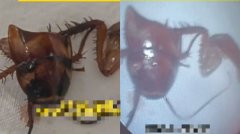 睡觉时蟑螂钻进耳朵 中国男子挖出半截蟑